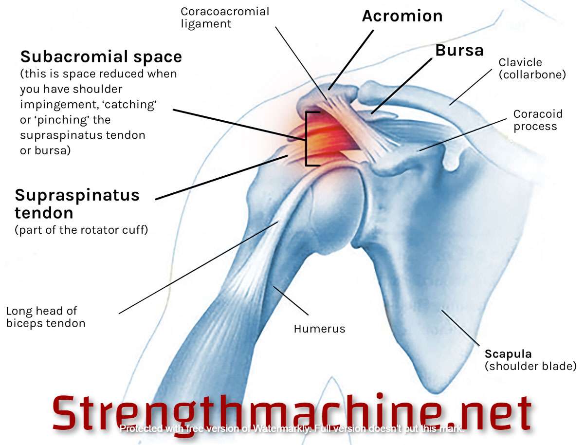 You are currently viewing Top 5 Shoulder Impingement Exercises and Stretches